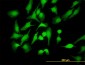 PBK Antibody (monoclonal) (M07)